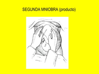 SEGUNDA MNIOBRA (producto)  