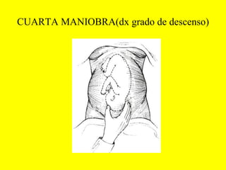 CUARTA MANIOBRA(dx grado de descenso) 