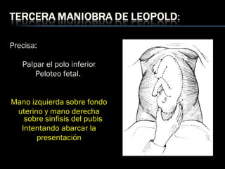 Precisa:
Palpar el polo inferior
Peloteo fetal.
Mano izquierda sobre fondo
uterino y mano derecha
sobre sinfisis del pubis
Intentando abarcar la
presentación
 