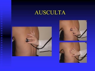 AUSCULTA
 