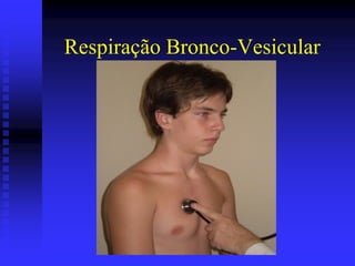 Respiração Bronco-Vesicular
 