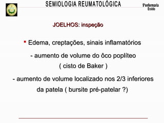JOELHOS: inspeção

 Edema, creptações, sinais inflamatórios
- aumento de volume do ôco poplíteo
( cisto de Baker )
- aumento de volume localizado nos 2/3 inferiores
da patela ( bursite pré-patelar ?)

 