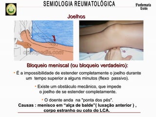 Joelhos

Bloqueio meniscal (ou bloqueio verdadeiro):
• É a impossibilidade de estender completamente o joelho durante
um tempo superior a alguns minutos (flexo passivo).
• Existe um obstáculo mecânico, que impede
o joelho de se estender completamente.
• O doente anda na "ponta dos pés".
Causas : menisco em “alça de balde”( luxação anterior ) ,
corpo estranho ou coto do LCA.

 