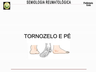 TORNOZELO E PÉ

 
