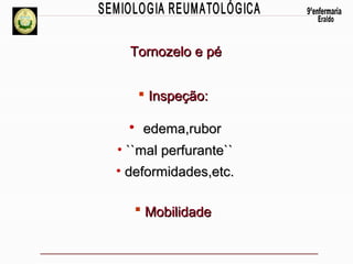 Tornozelo e pé
 Inspeção:

• edema,rubor
• ``mal perfurante``
• deformidades,etc.
 Mobilidade

 