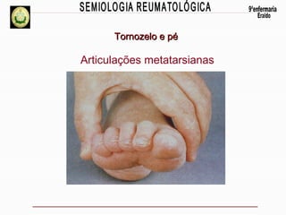 Tornozelo e pé

Articulações metatarsianas

 