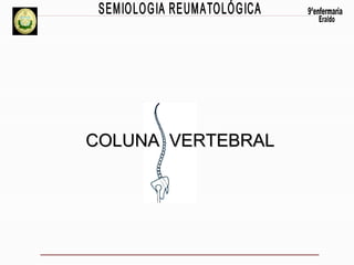 COLUNA VERTEBRAL

 