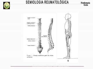 Alinhamento da coluna

 