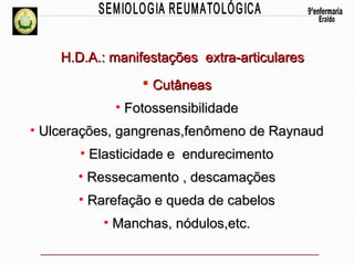 H.D.A.: manifestações extra-articulares
 Cutâneas
• Fotossensibilidade
• Ulcerações, gangrenas,fenômeno de Raynaud
• Elasticidade e endurecimento
• Ressecamento , descamações
• Rarefação e queda de cabelos
• Manchas, nódulos,etc.

 