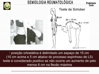Teste de Schober

• posição ortostática é delimitado um espaço de 15 cm
(10 cm acima e 5 cm abaixo do processo espinhoso de L5)
teste é considerado positivo se não ocorre um aumento de pelo
menos 6 cm na flexão máxima

 