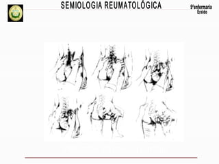 Palpação da coluna lombar

 
