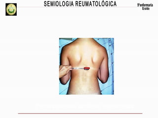 Percussão das apófises espinhosas

 