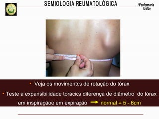 • Veja os movimentos de rotação do tórax
• Teste a expansibilidade torácica diferença de diâmetro do tórax
em inspiraçãoe em expiração

normal = 5 - 6cm

 