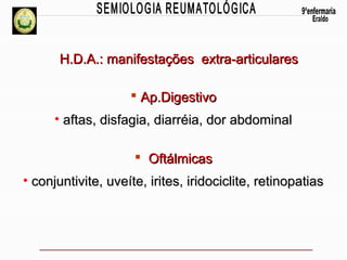 H.D.A.: manifestações extra-articulares
 Ap.Digestivo
• aftas, disfagia, diarréia, dor abdominal
 Oftálmicas
• conjuntivite, uveíte, irites, iridociclite, retinopatias

 