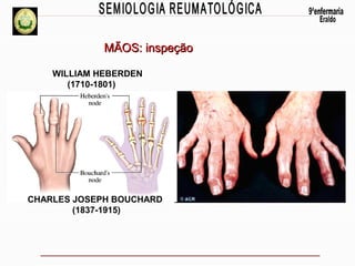 MÃOS: inspeção
WILLIAM HEBERDEN
(1710-1801)

CHARLES JOSEPH BOUCHARD
(1837-1915)

 