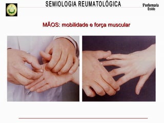 MÃOS: mobilidade e força muscular

 