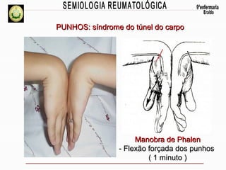 PUNHOS: síndrome do túnel do carpo

Manobra de Phalen
- Flexão forçada dos punhos
( 1 minuto )

 