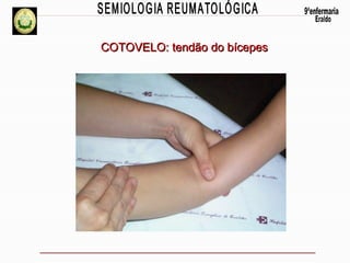 COTOVELO: tendão do bícepes

 