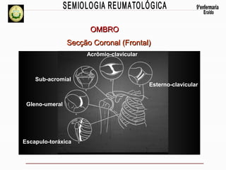 OMBRO
Secção Coronal (Frontal)
Acrômio-clavicular

Sub-acromial

Gleno-umeral

Escapulo-toráxica

Esterno-clavicular

 