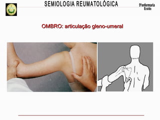 OMBRO: articulação gleno-umeral

 