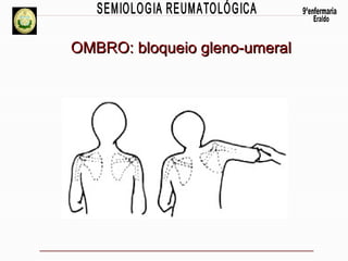OMBRO: bloqueio gleno-umeral

 