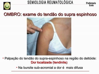 OMBRO: exame do tendão do supra espinhoso

• Palpação do tendão do supra-espinhoso na região do deltóide:
Dor localizada (tendinite)
• Na bursite sub-acromial a dor é mais difusa

 