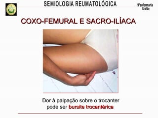 COXO-FEMURAL E SACRO-ILÍACA

Dor à palpação sobre o trocanter
pode ser bursite trocantérica

 