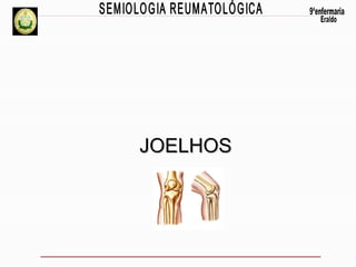 JOELHOS

 