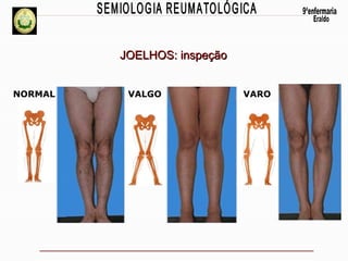 Propedeutica reumato eraldoxx2012