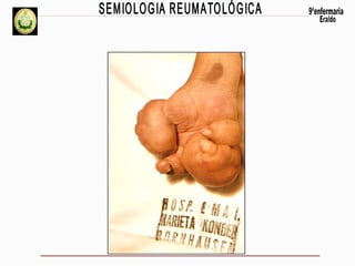 Propedeutica reumato eraldoxx2012