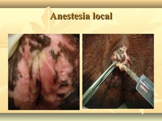 Anestesia local

 