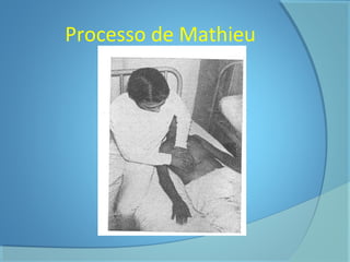 Processo de Mathieu 
 