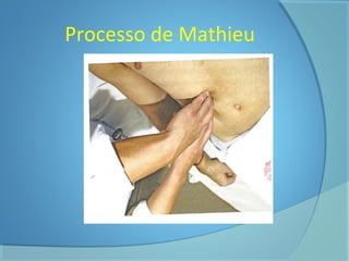 Processo de Mathieu 
 