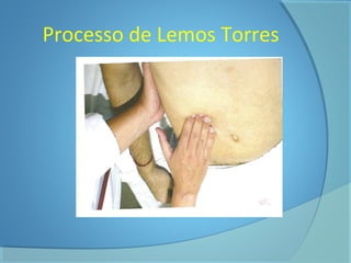 Processo de Lemos Torres 
 