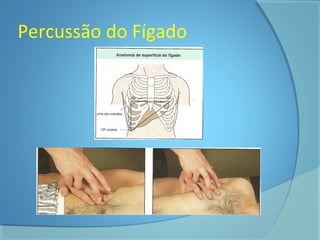 Percussão do Fígado 
 