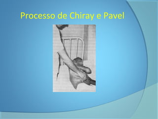 Processo de Chiray e Pavel 
 