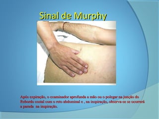 SSiinnaall ddee MMuurrpphhyy 
AAppóóss eexxppiirraaççããoo,, oo eexxaammiinnaaddoorr aapprrooffuunnddaa aa mmããoo oouu oo ppoolleeggaarr nnaa jjuunnççããoo ddoo 
RReebboorrddoo ccoossttaall ccoomm oo rreettoo aabbddoommiinnaall ee ,, nnaa iinnssppiirraaççããoo,, oobbsseerrvvaa--ssee ssee ooccoorrrreerráá 
aa ppaarraaddaa nnaa iinnssppiirraaççããoo.. 
 