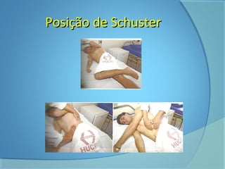 PPoossiiççããoo ddee SScchhuusstteerr 
 