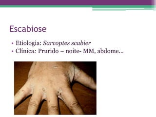 Escabiose
• Etiologia: Sarcoptes scabier
• Clínica: Prurido – noite- MM, abdome...
 