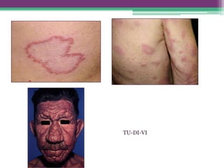 TU-DI-VI
 