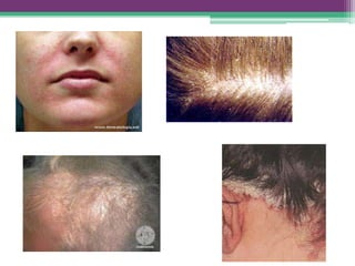 Propedêutica dermatológica