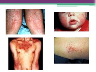 Propedêutica dermatológica