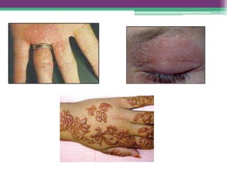 Propedêutica dermatológica