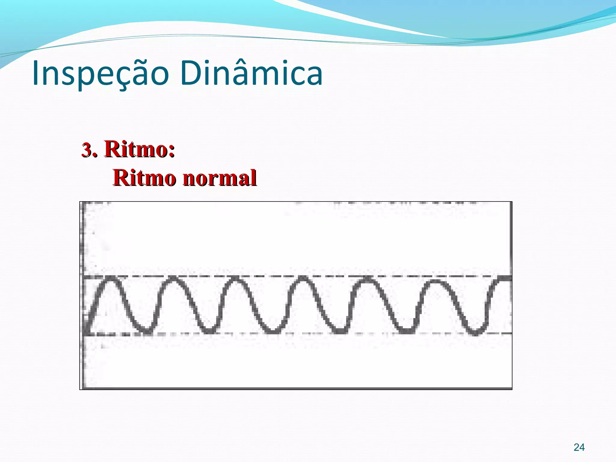 Inspeção Dinâmica
24
33. Ritmo:. Ritmo:
Ritmo normalRitmo normal
 