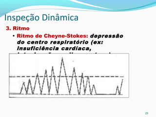 Inspeção Dinâmica
3. Ritmo
• Ritmo de Cheyne-Stokes: depressão
do centro respiratório (ex:
insuficiência cardíaca,
intoxicação medicamentosa)
25
 
