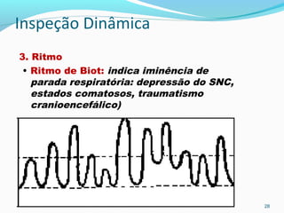 Inspeção Dinâmica
3. Ritmo
• Ritmo de Biot: indica iminência de
parada respiratória: depressão do SNC,
estados comatosos, traumatismo
cranioencefálico)
28
 