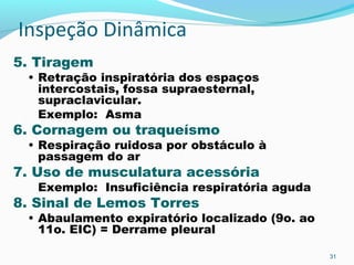 Inspeção Dinâmica
5. Tiragem
• Retração inspiratória dos espaços
intercostais, fossa supraesternal,
supraclavicular.
Exemplo: Asma
6. Cornagem ou traqueísmo
• Respiração ruidosa por obstáculo à
passagem do ar
7. Uso de musculatura acessória
Exemplo: Insuficiência respiratória aguda
8. Sinal de Lemos Torres
• Abaulamento expiratório localizado (9o. ao
11o. EIC) = Derrame pleural
31
 
