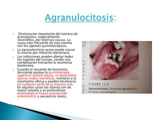 Agranulocitosis: Disminución importante del número de granulositos, especialmente neutrófilos, por diversas causas. La causa mas frecuente de esta anemia son los agentes quimioterápicos.La agranulocitosis grave puede causar la muerte por infección bacteriana.Las infecciones pueden afectar todos los órganos del cuerpo, siendo una complicación frecuente la neumonía bacteriana.Cuando el recuento de leucocitos desciende porque la quimioterapia superó el umbral tóxico, se desarrollan úlceras orales necróticas, similares a la estomatitis aftosa y pueden localizarse en cualquier parte de la mucosa oral. En algunos casos las úlceras son de mayor tamaño y se profundizan alcanzando el hueso provocando osteomielitis y secuestros óseos.