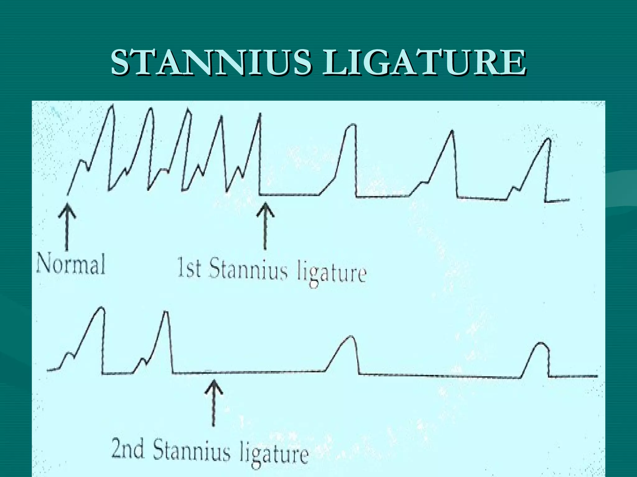 Properties of cardiac muscles PPT