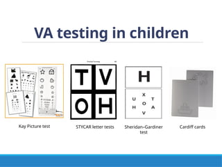 VA testing in children
Kay Picture test STYCAR letter tests Sheridan–Gardiner
test
Cardiff cards
 